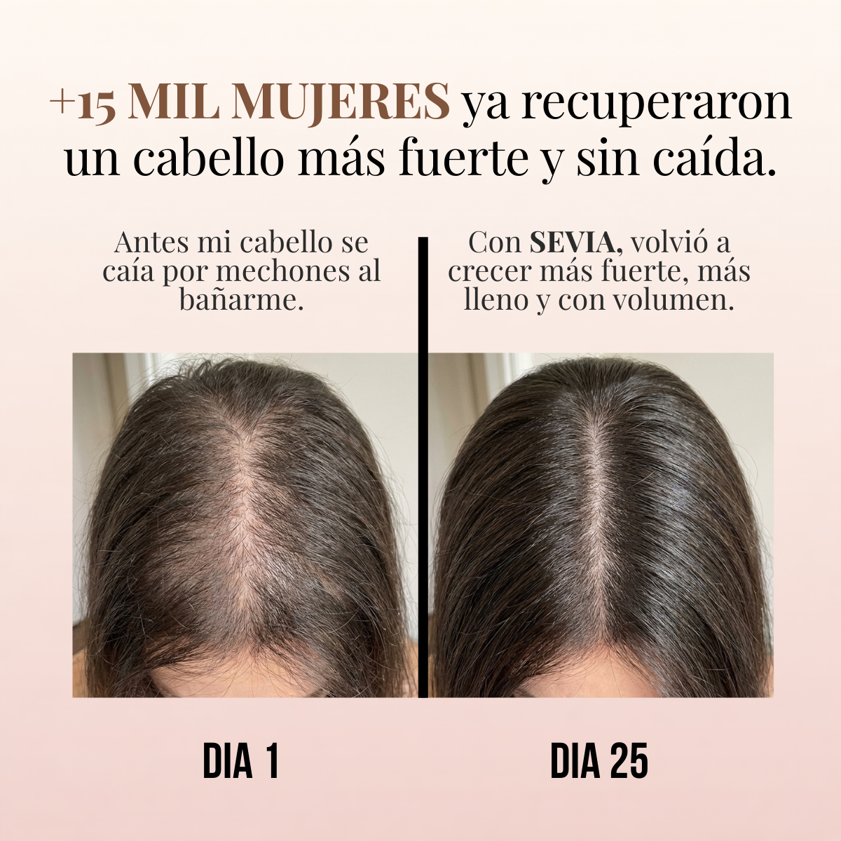 Sevia - Shampoo Reactivador de Microcirculación Capilar